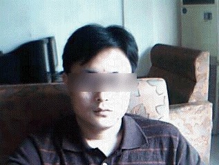 消脂保肝疗法治疗脂肪